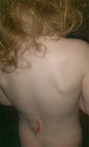 back-scratch